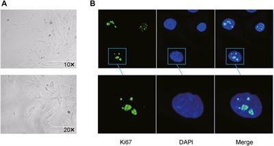 Construction of a HOXA11-AS-Interacted Network in Keloid Fibroblasts Using Integrated Bioinformatic Analysis and in Vitro Validation